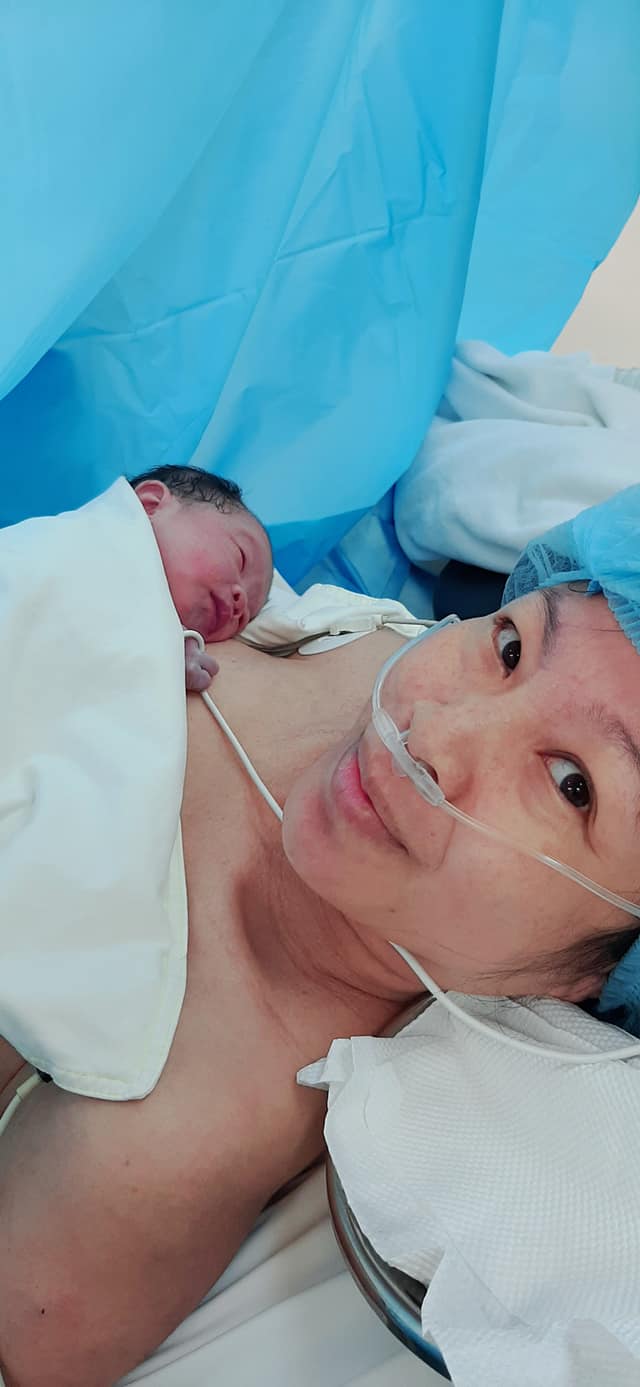 MAY MẮN SINH CON Ở TUỔI 42 CỦA NGƯỜI PHỤ NỮ CÓ TIỀN SỬ BỊ LẠC TUYẾN CƠ TỬ CUNG